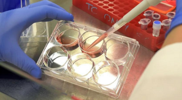 Gloved Hands Pipetting Samples in Laboratory Setting